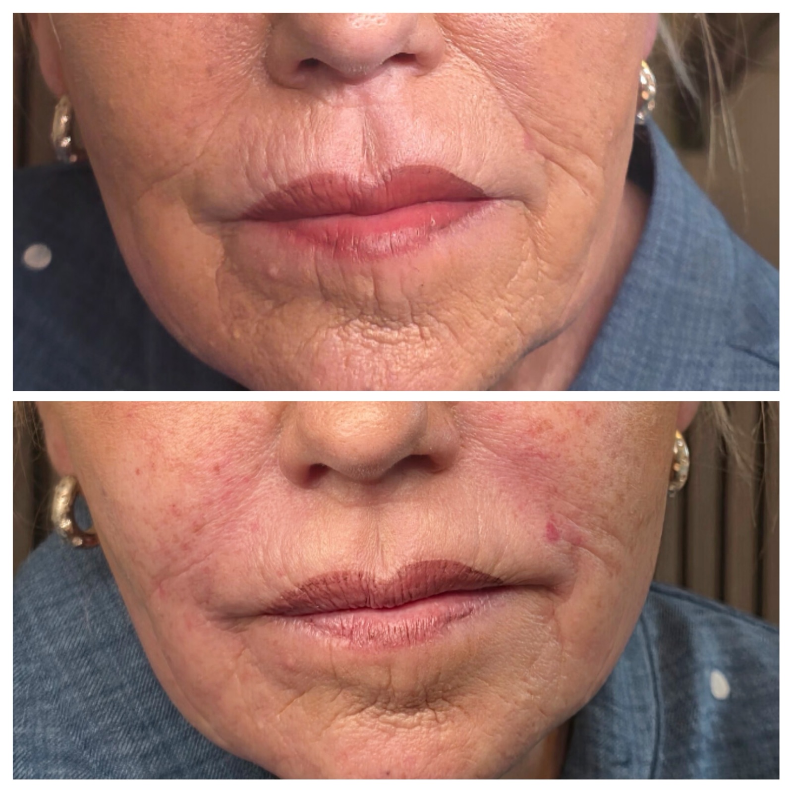 Before and after