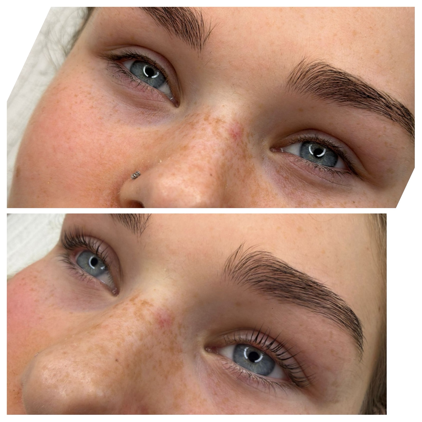 Brow shaping